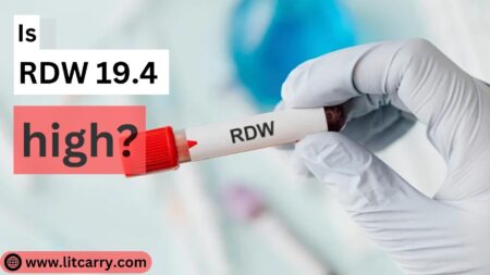 What Level Of RDW Is Dangerous?